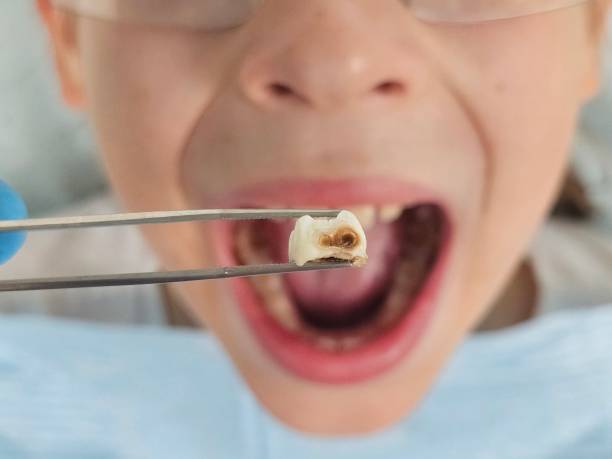 Best Emergency Root Canal Therapy in Crump, TN